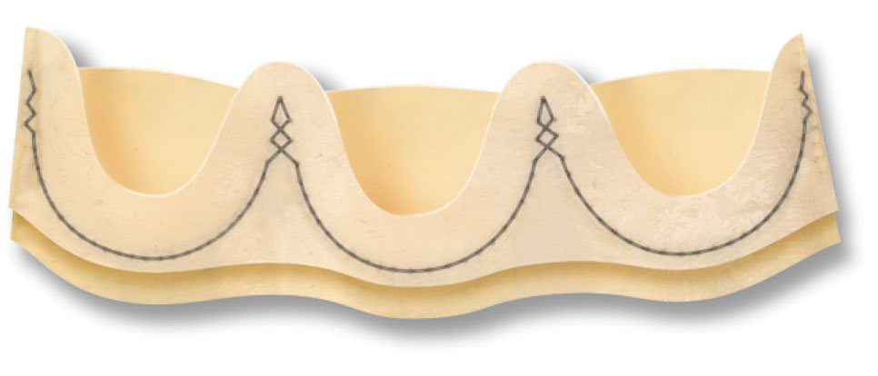 Sorin - Pericarbon More Mitral Stented Pericardial Valve