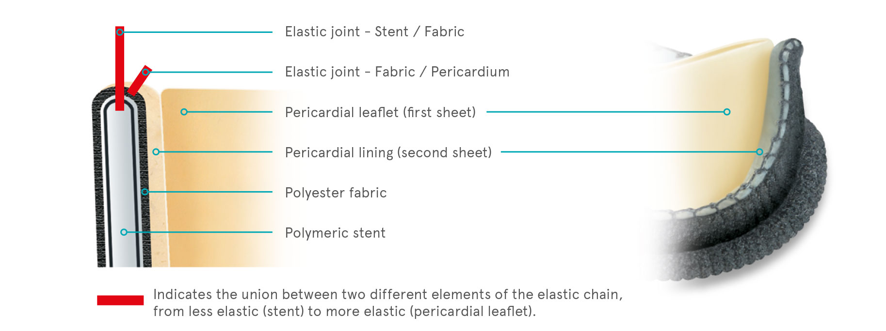 Sorin - Pericarbon More Mitral Stented Pericardial Valve