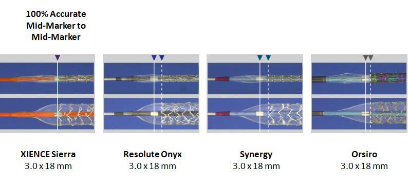 Xience Sierra Everolimus Eluting Coronary Stent - Abbott Vascular