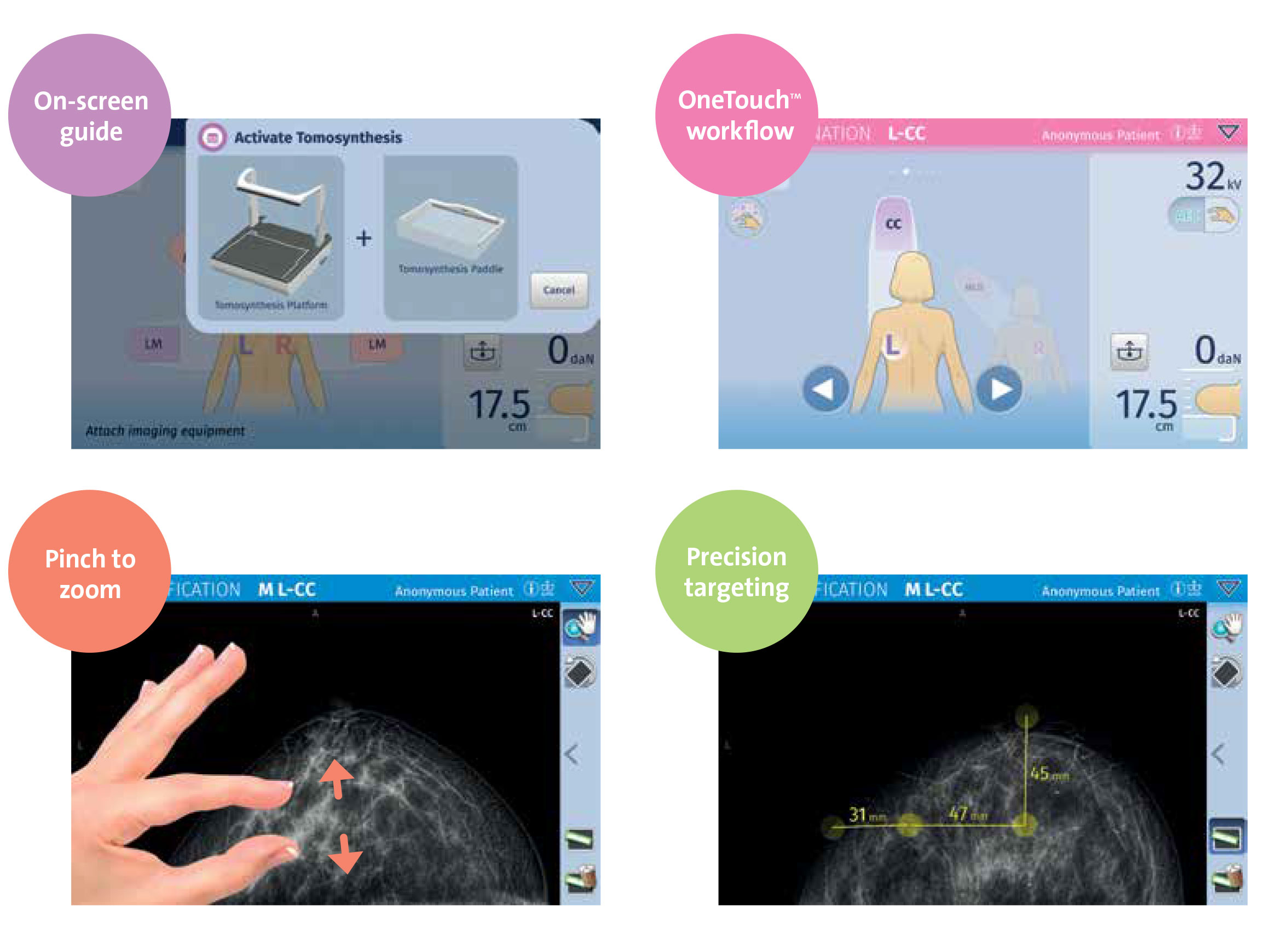 Planmed Clarity 3D - Digital Breast Tomosynthesis