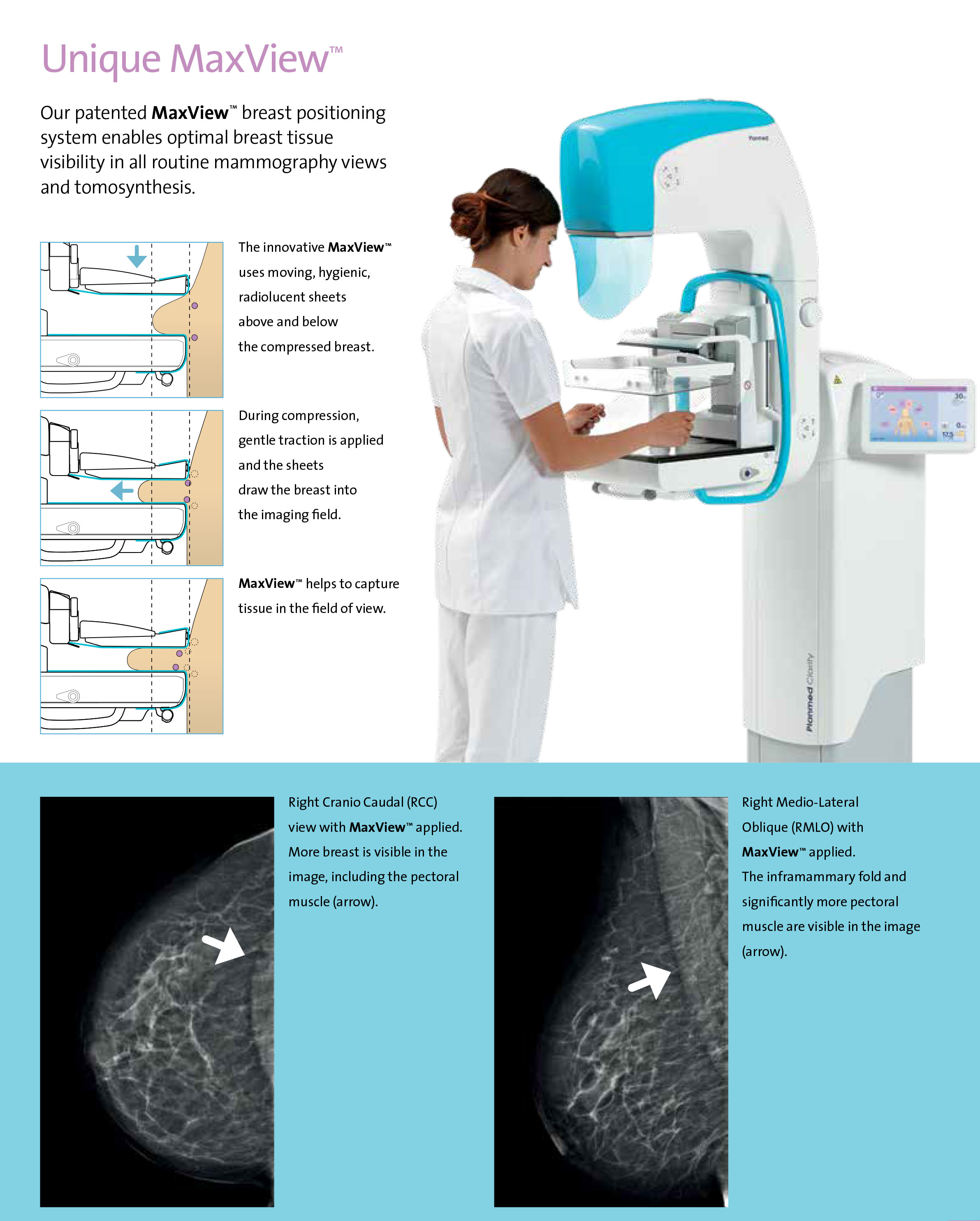 Planmed Clarity 3D - Digital Breast Tomosynthesis