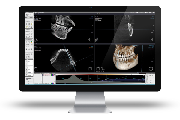 X-VIEW 3D PAN