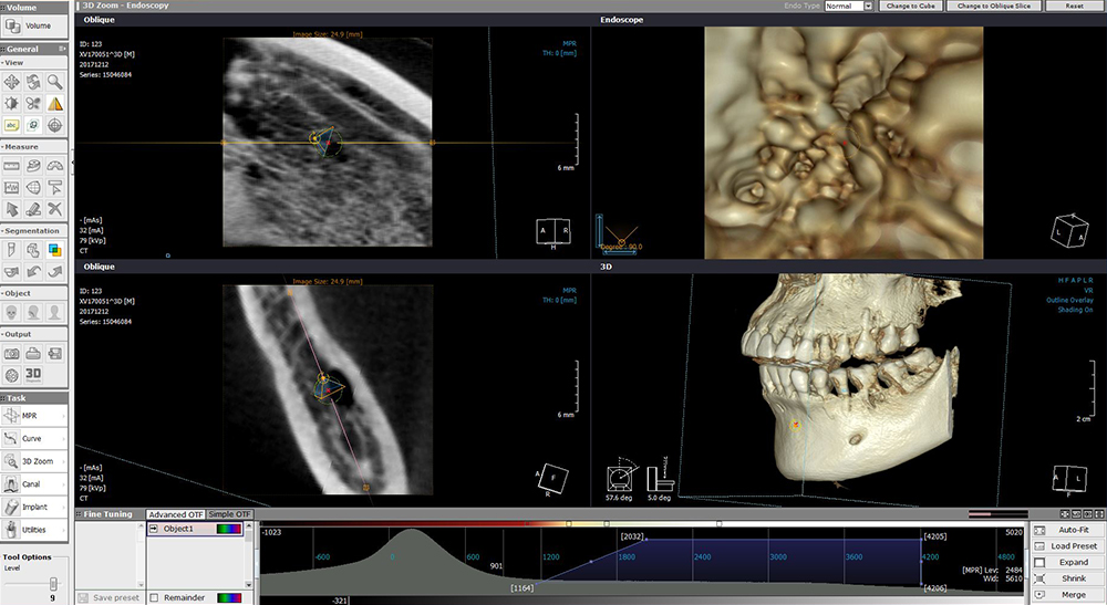 x-view 3d pan