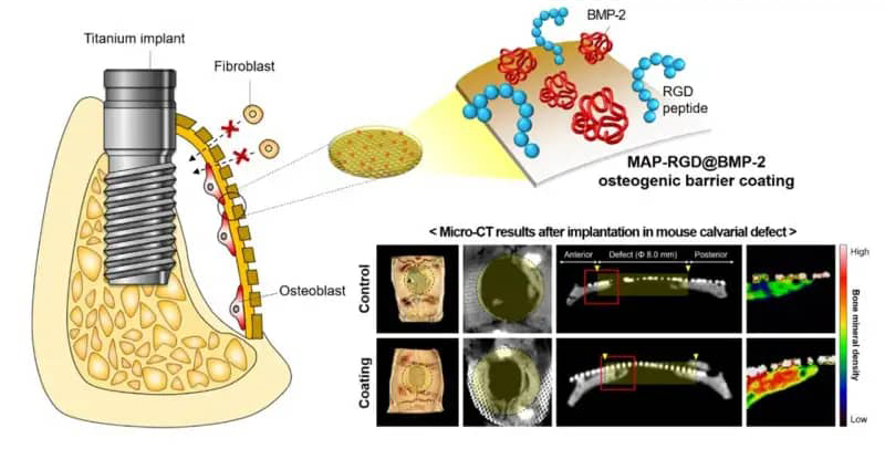 Accelerating Bone Regeneration for Enhanced Dental Implant Success