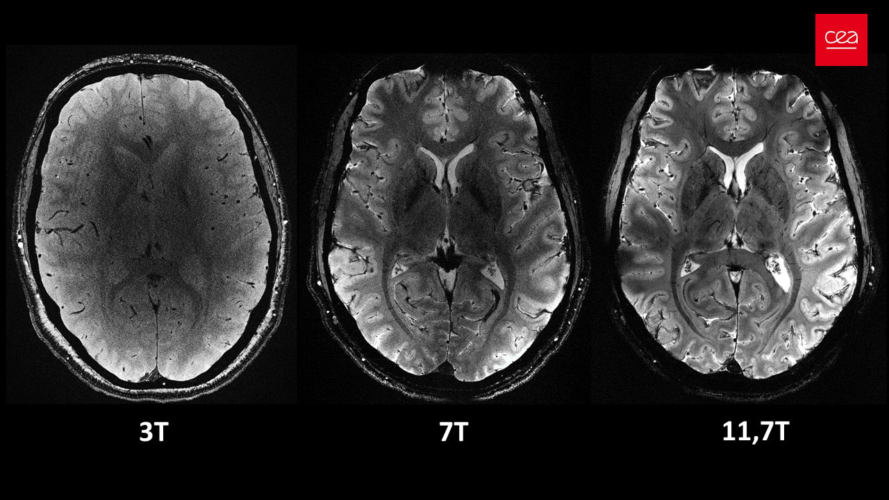 CEA - The Most Powerful MRI Machine Model Iseult