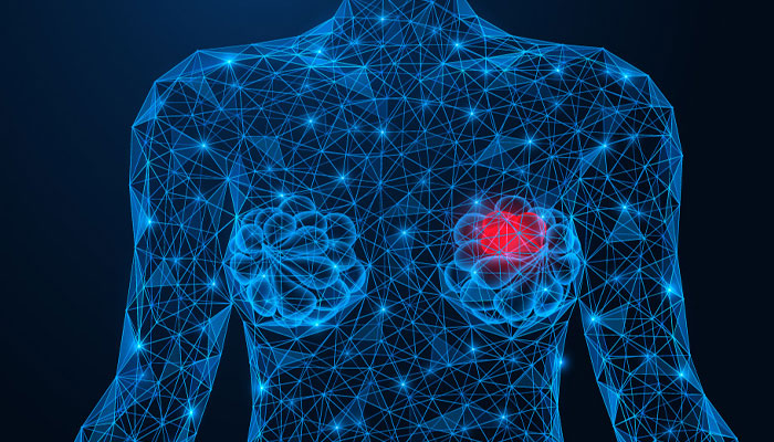 LumiSystm Fluorescence Imaging System: Detecting Residual Breast Cancer 