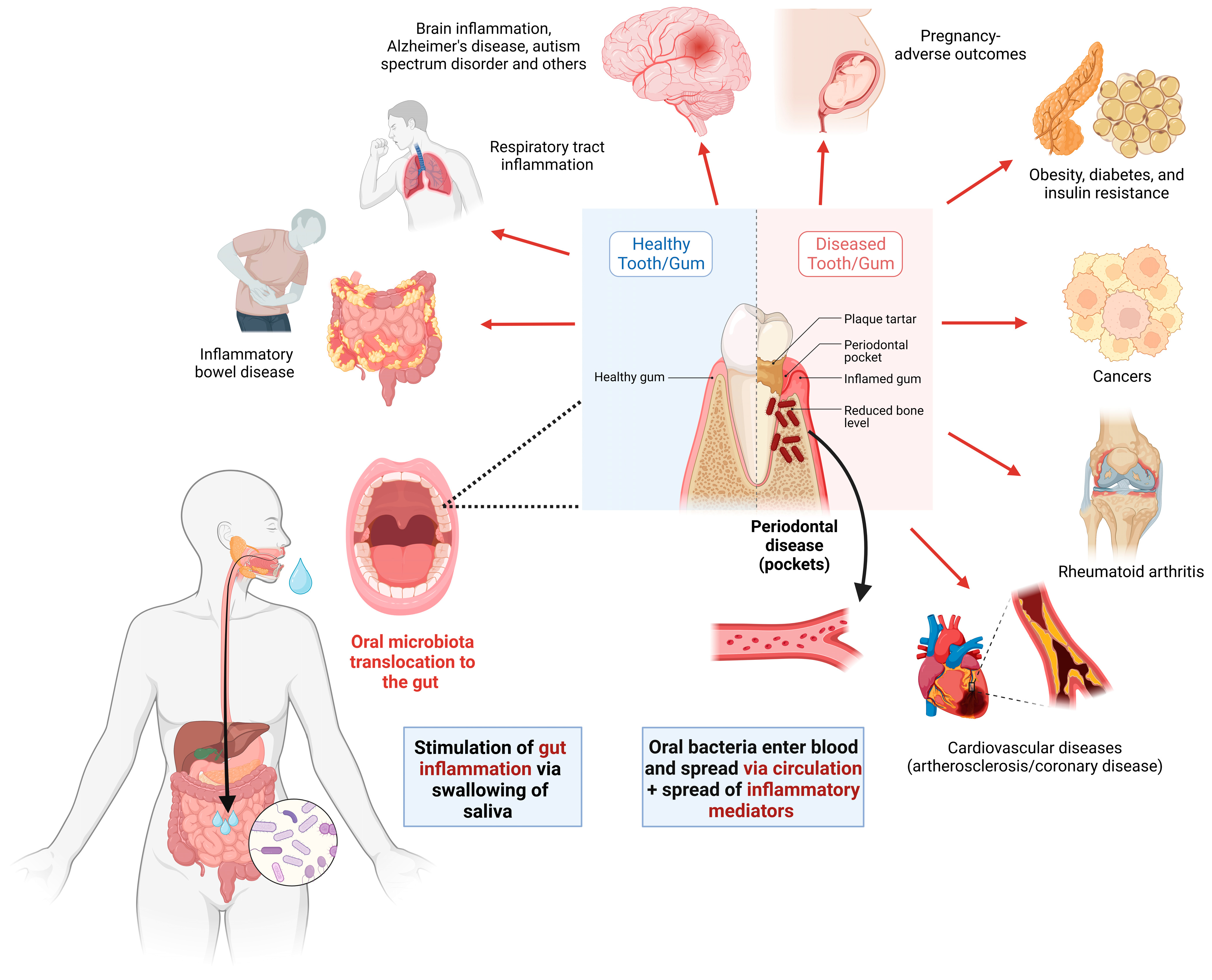 The bacteria in your mouth are important for your health - Four diseases link to your oral microbiome