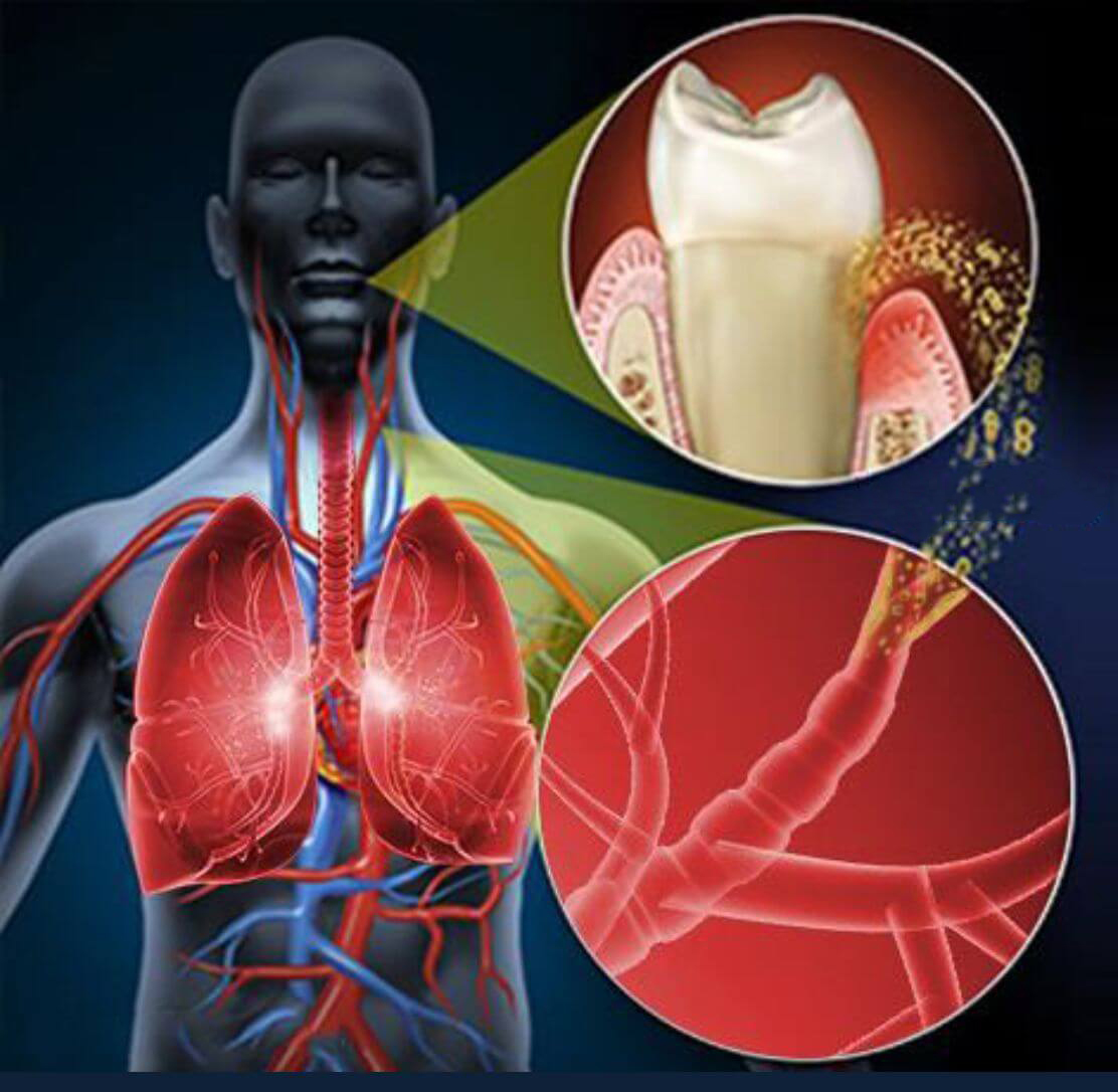 The bacteria in your mouth are important for your health - Four diseases link to your oral microbiome