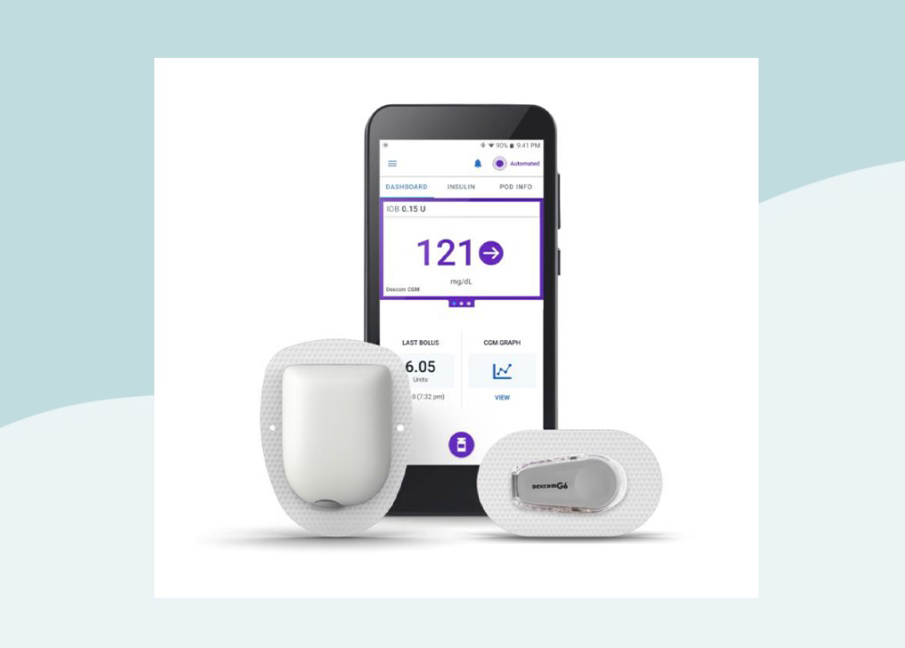 پمپ انسولین هوشمند مدل Omnipod 5: تاثیر قابل توجه بر روی دیابت نوع 2