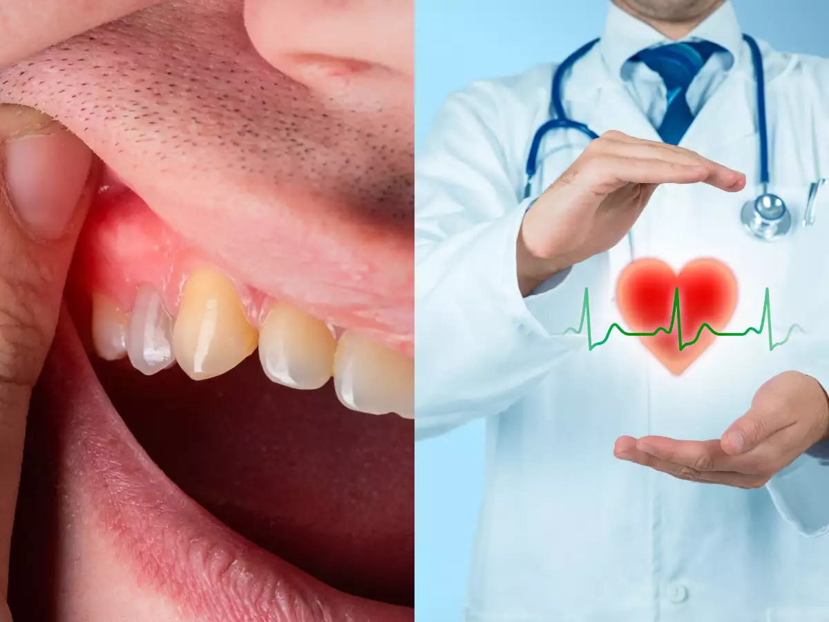 Treating gum disease after heart rhythm ablation reduces risk of AFib recurrence