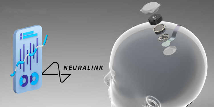 Elon Mask First Implants Brain Chip in First Human