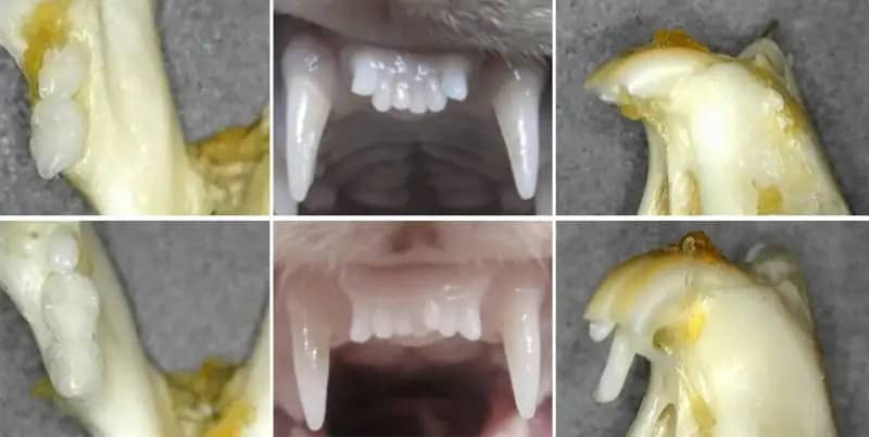 A New Era in Dentistry: Regrowing Lost Teeth with Japanese Innovation