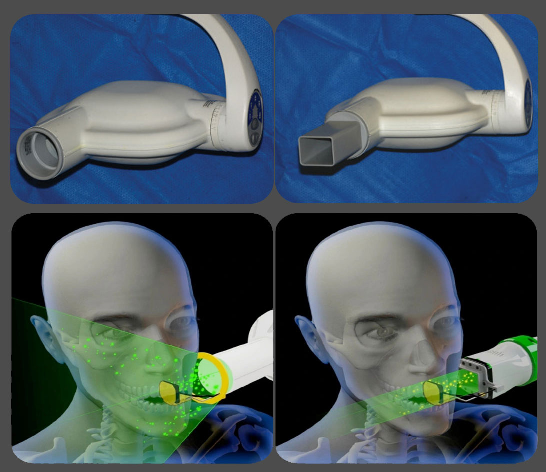 xray collimation