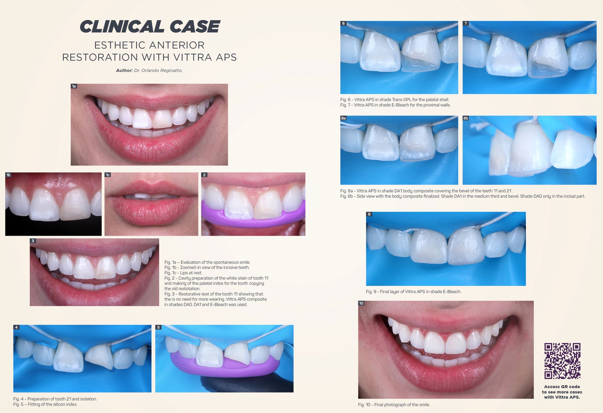 vittra aps clinical case fgm