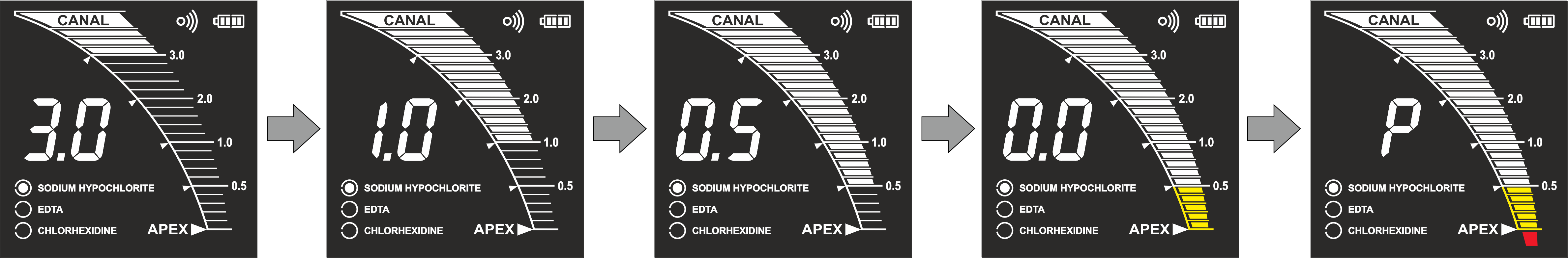 EndoEst-Apex 02 (С) advantages