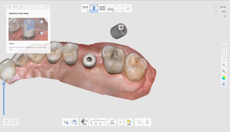 medit-i700-scan-body-matching