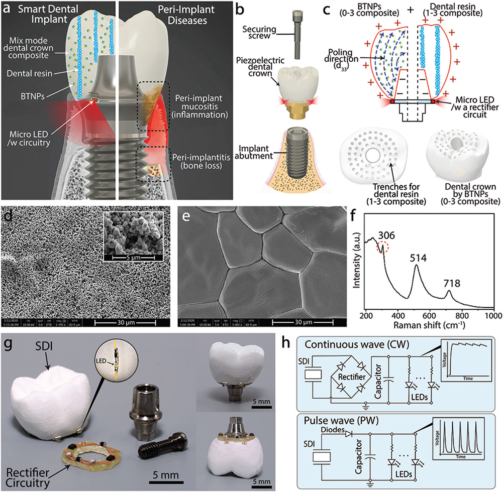 Human Oral Motion-Powered Smart Dental Implant (SDI) for In Situ Ambulatory Photo-biomodulation Therapy