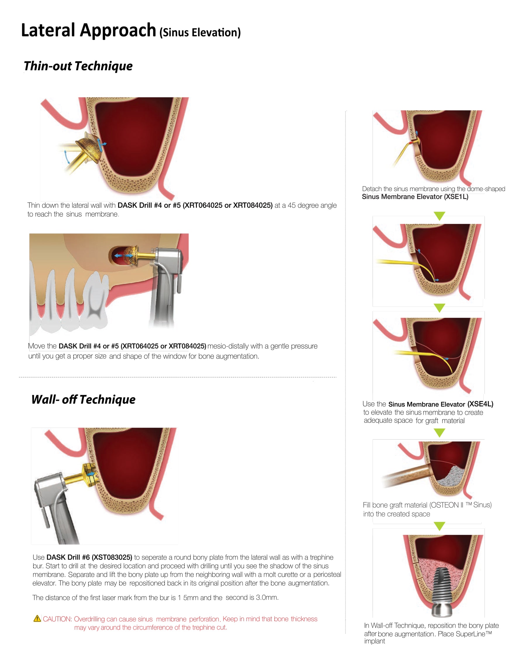 Dentium Advanced Sinus Kit - DASK