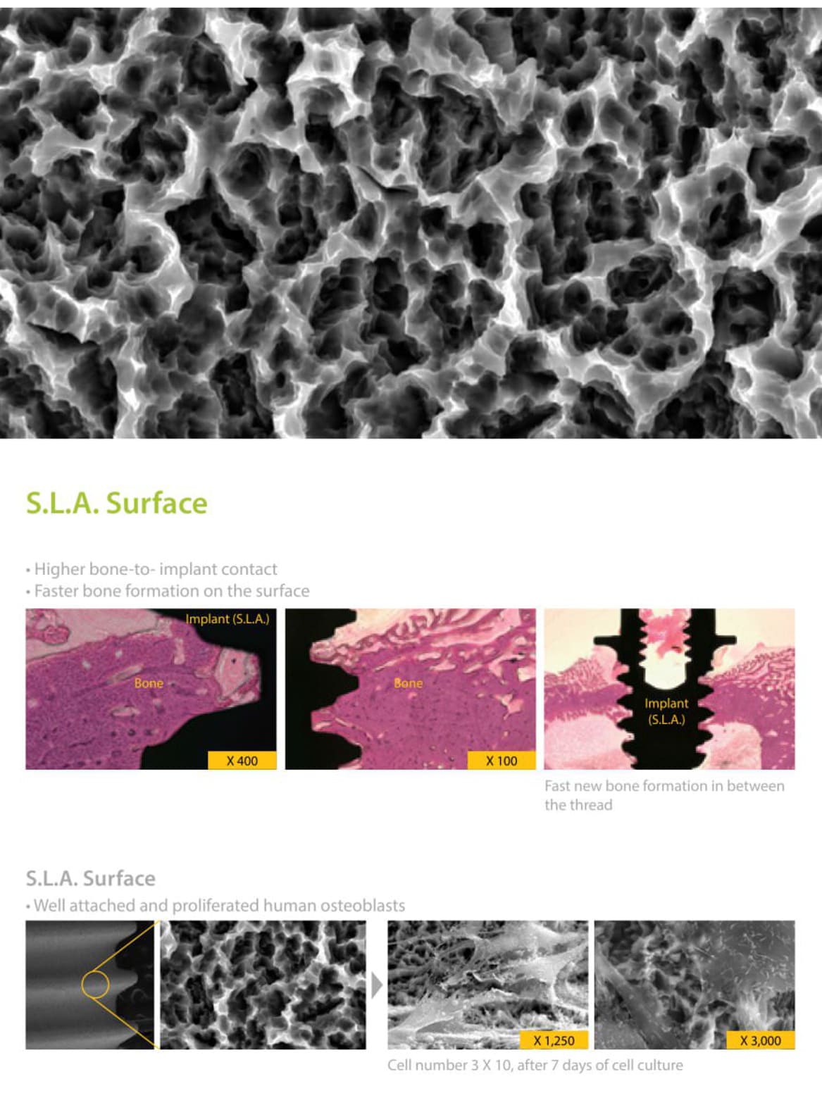 Dentium NR Line SLA Surface