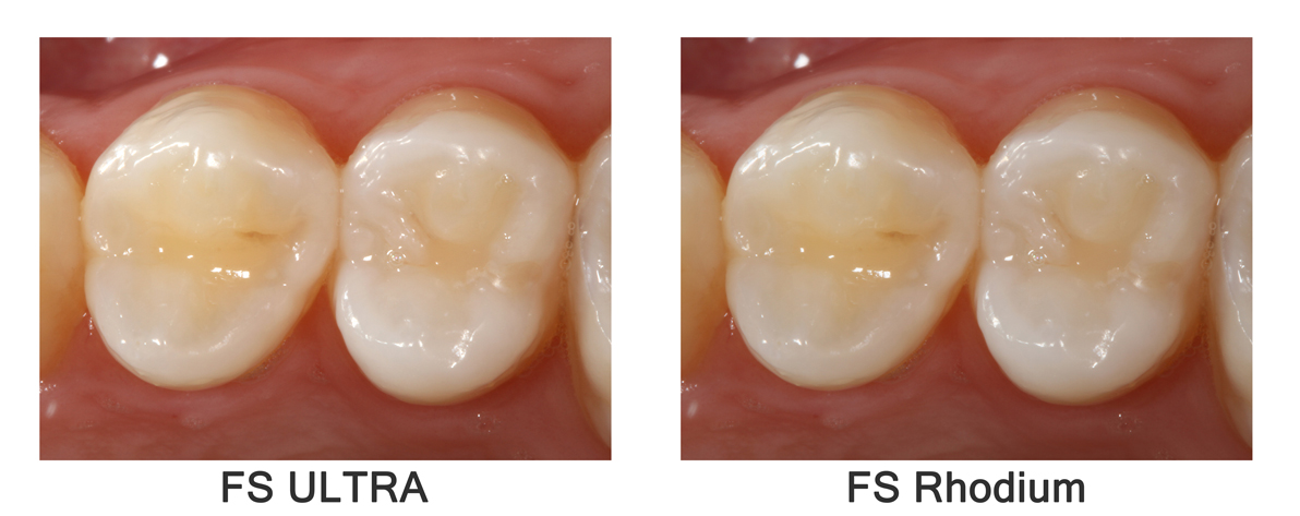 RELAX FS ULTRA vs. RELAX FS Rhodium