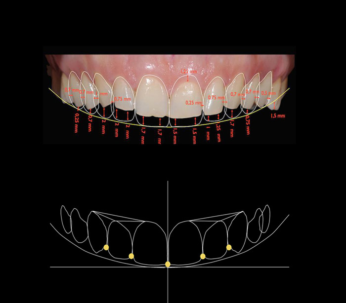 digital smile design