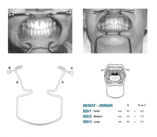 cheek retractor