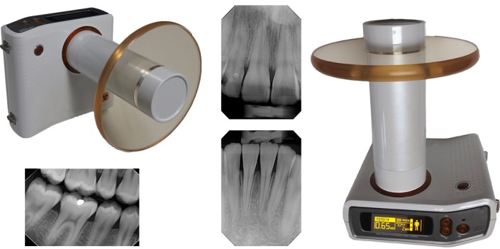 MobileX handheld intraoral x-ray system