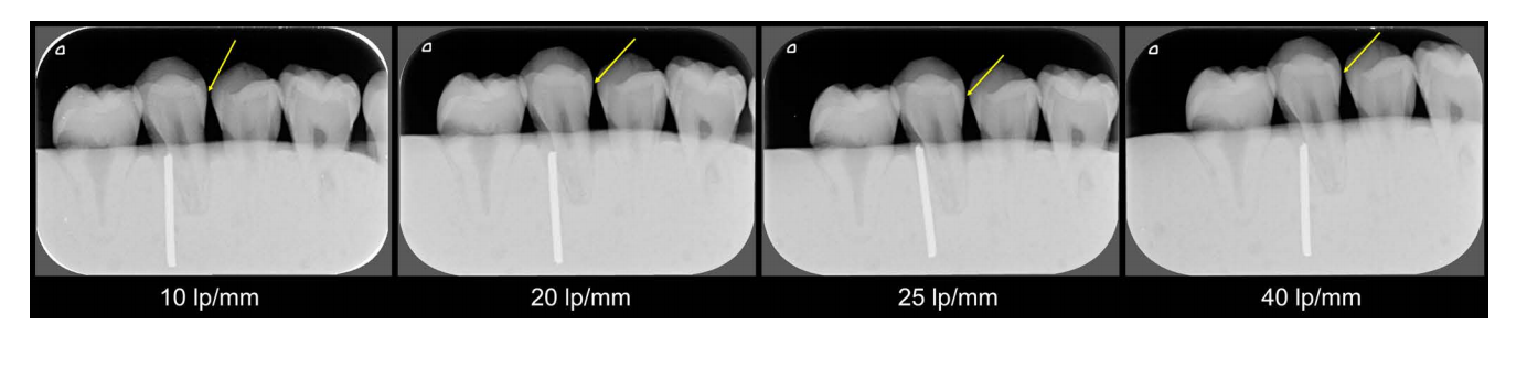 Phosphor Plate System