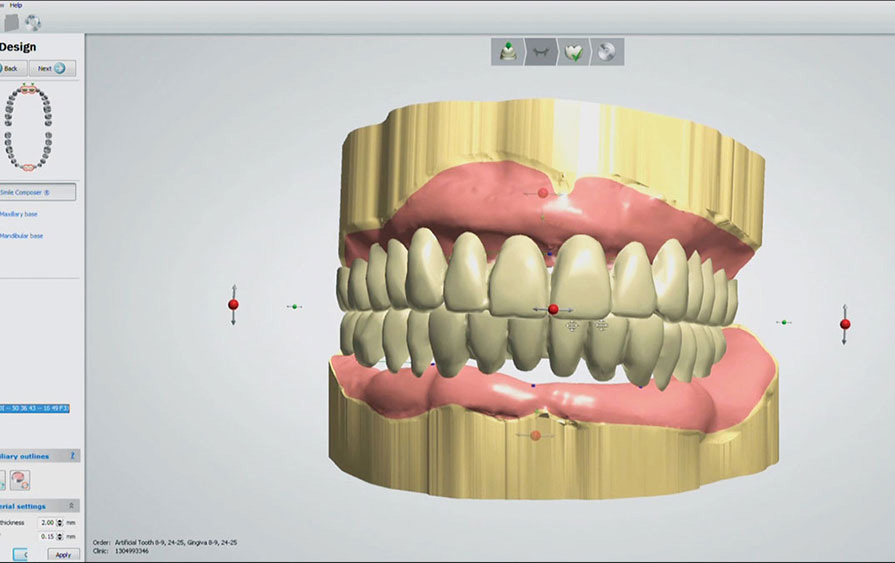 dentures