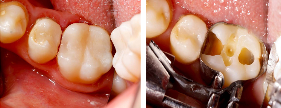 Endodontics