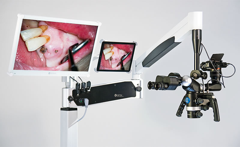 Endodontics technology