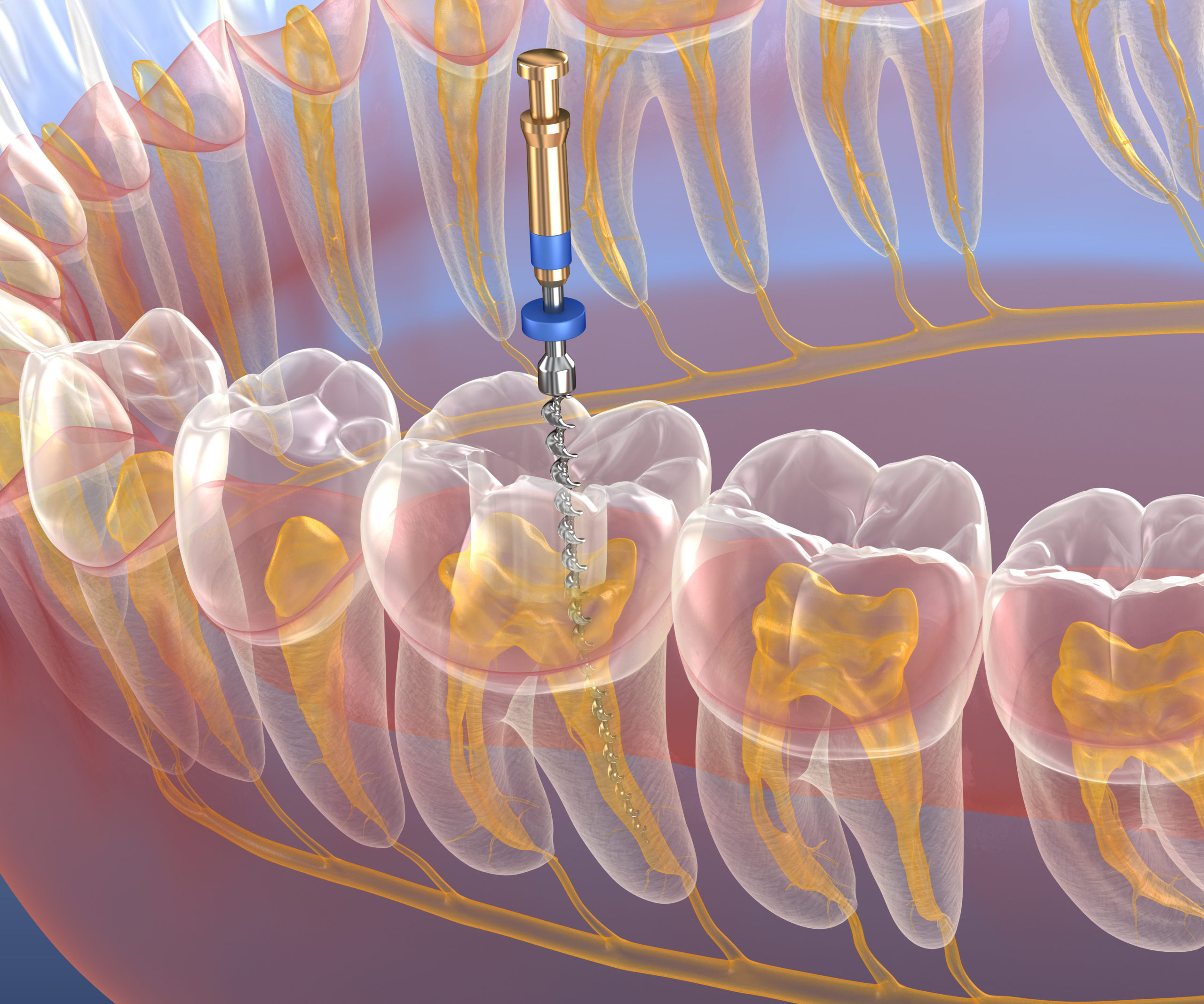 Endodontics