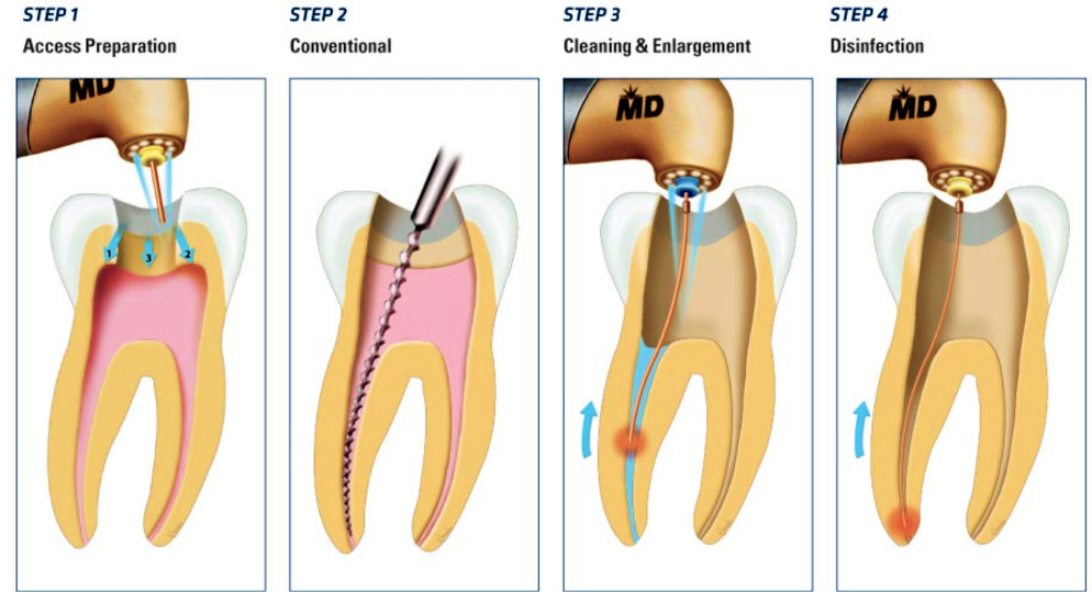 Endodontics