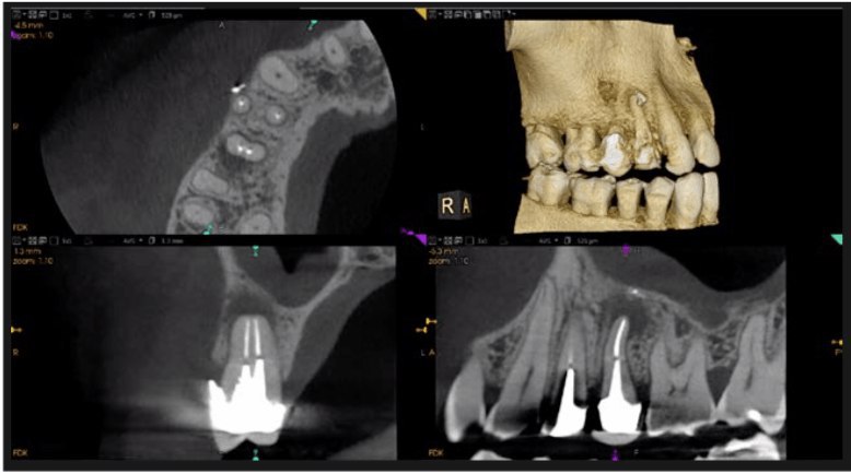 CS 9600 CBCT