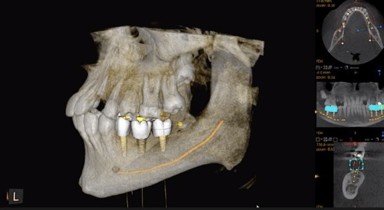 CS 9600 CBCT