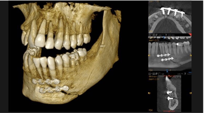 CS 9600 CBCT