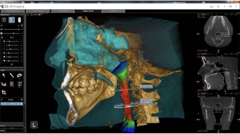 CS 9600 CBCT