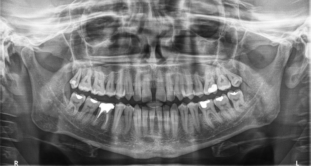 CS 9600 CBCT