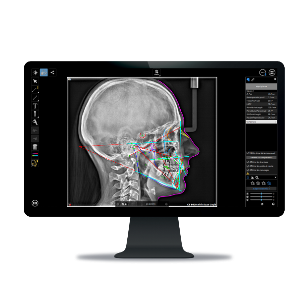 CS 9600 CBCT