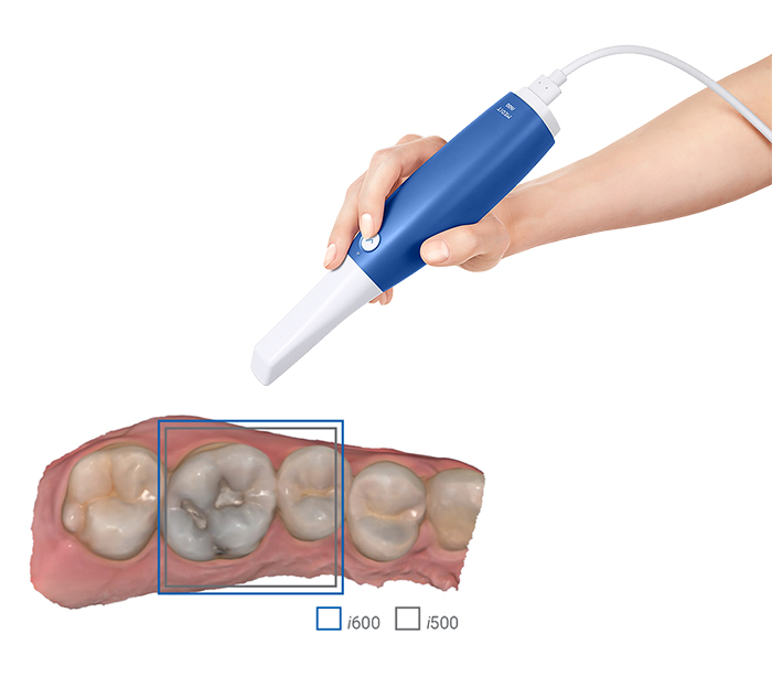 medit i600 Full-arch accuracy