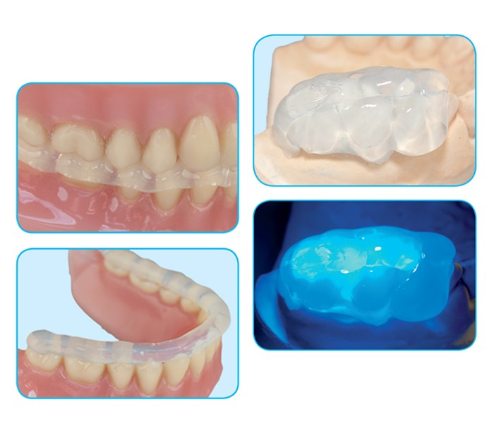 oxford Transparent A-Silicone as Matrix Material and for Bite Registration