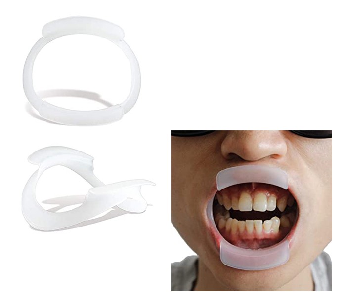 Teeth Whitening Cheek Retractor
