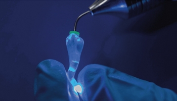 OdneCure Light Cure Device: The  thinnest optical fiber tip to reach the thinnest root canal