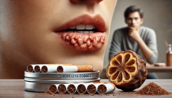 The Role of Smokeless Tobacco and Areca Nut in Oral Cancer Risk