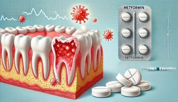 Can a common diabetes drug help treat gum disease and promote healthy aging?