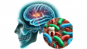 Gum Disease and Alzheimer's: Uncovering a Hidden Link