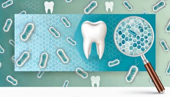 New Discovery in Oral Bacteria and Its Role in Tooth Decay