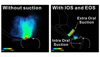 Boosting Dental Safety: The power of Intra-Oral and Extra-Oral Suction Devices