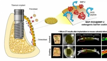 Accelerating Bone Regeneration for Enhanced Dental Implant Success