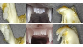 A New Era in Dentistry: Regrowing Lost Teeth with Japanese Innovation